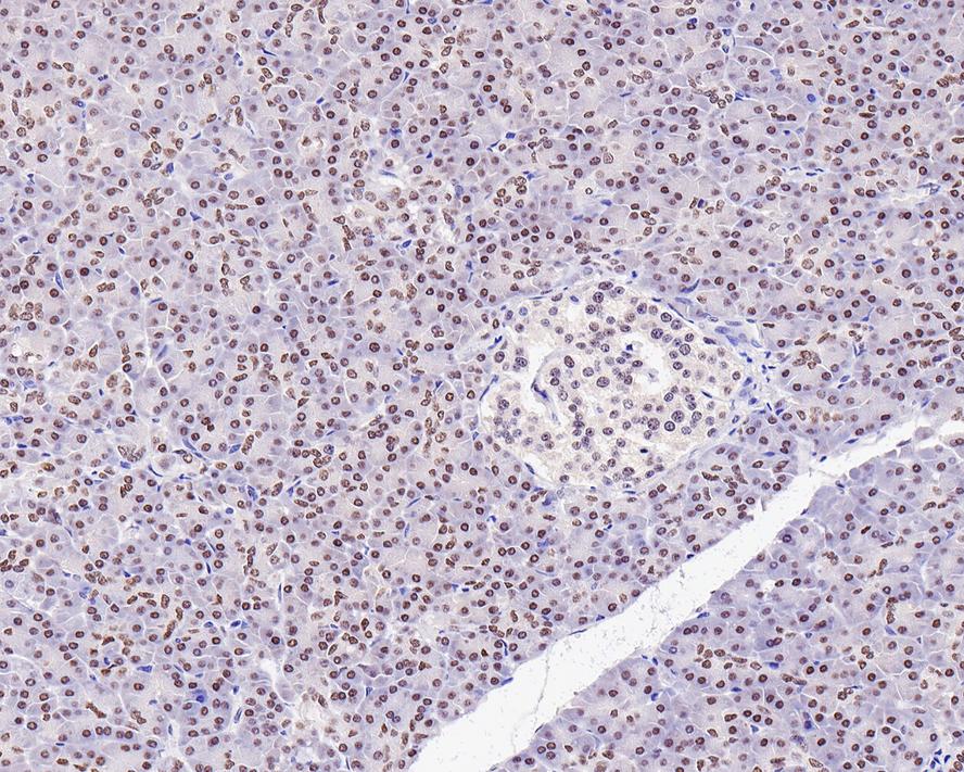 PBX1 Antibody (PSH0-24)