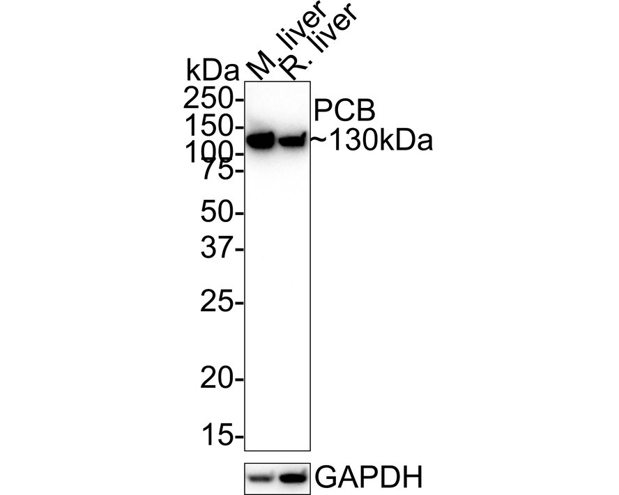 Pyruvate Carboxylase Antibody (JE40-24) Western Blot: Pyruvate Carboxylase Antibody (JE40-24) [NBP3-32721]