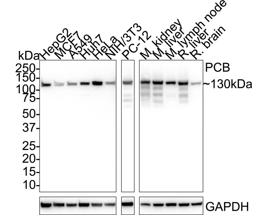 Pyruvate Carboxylase Antibody (PSH01-55) Western Blot: Pyruvate Carboxylase Antibody (PSH01-55) [NBP3-32722]
