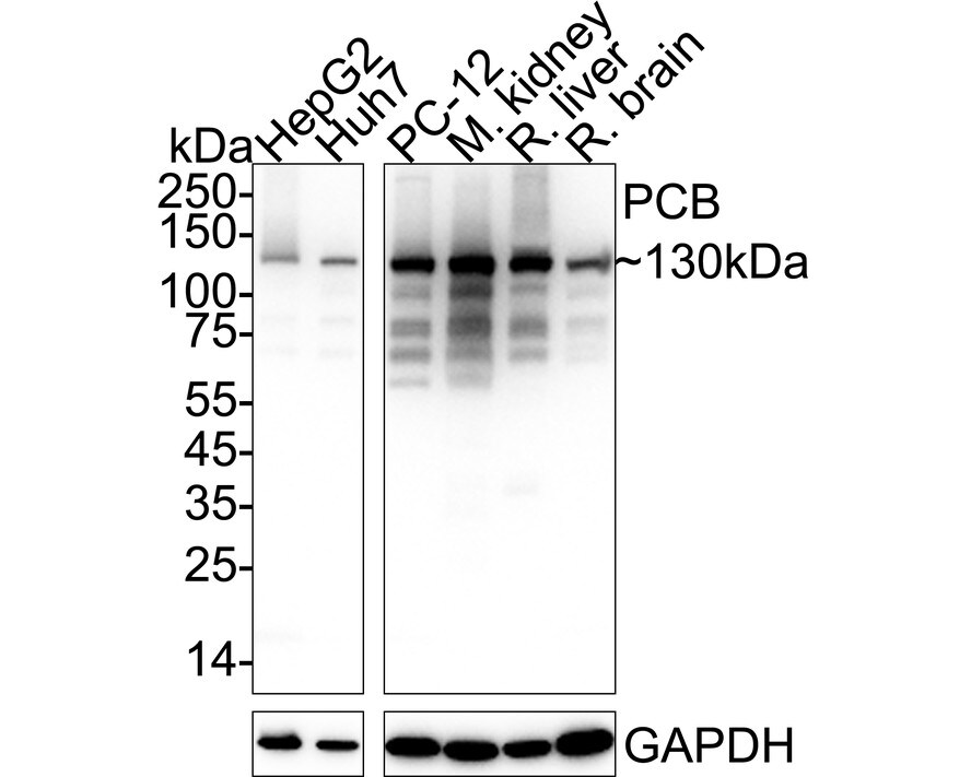 Pyruvate Carboxylase Antibody (PSH01-55) Western Blot: Pyruvate Carboxylase Antibody (PSH01-55) [NBP3-32722]