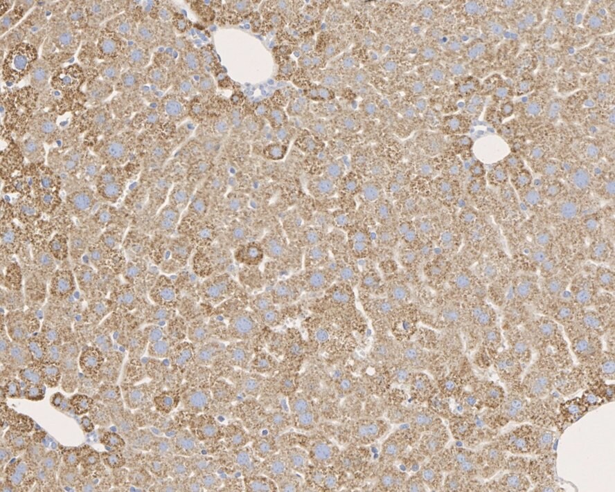 Pyruvate Carboxylase Antibody (PSH01-55)