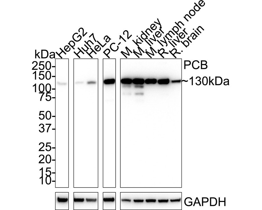 Pyruvate Carboxylase Antibody (PSH01-56) Western Blot: Pyruvate Carboxylase Antibody (PSH01-56) [NBP3-32723]