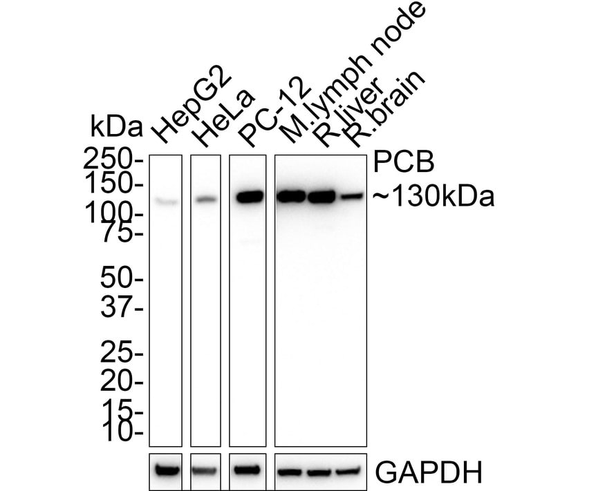 Pyruvate Carboxylase Antibody (PSH01-56)