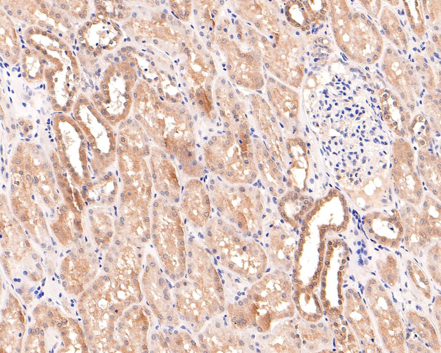 PCBP2 Antibody (JE65-05)