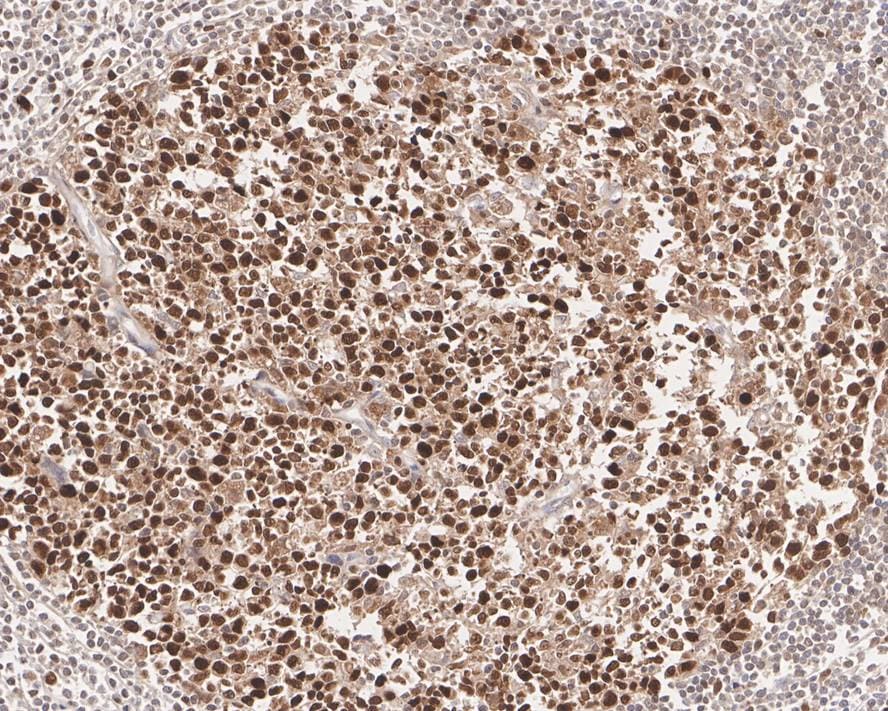 PCNA Antibody (A6-G11-R)