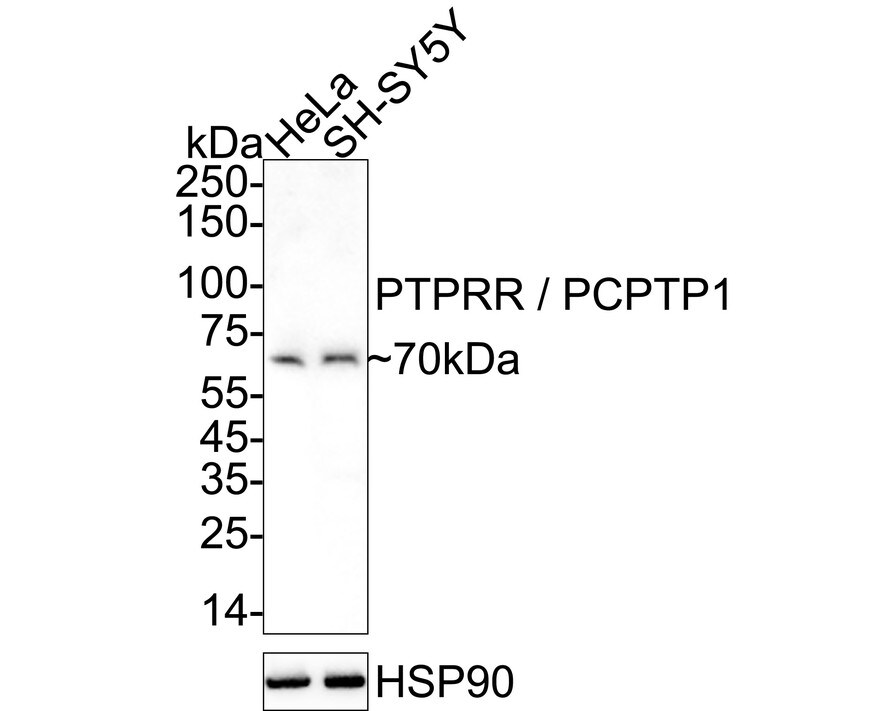PCPTP1 Antibody (JE64-84) Western Blot: PCPTP1 Antibody (JE64-84) [NBP3-32726]