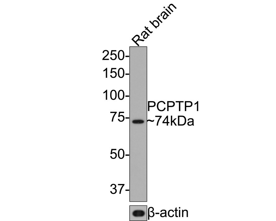 PCPTP1 Antibody (JE64-84) Western Blot: PCPTP1 Antibody (JE64-84) [NBP3-32726]