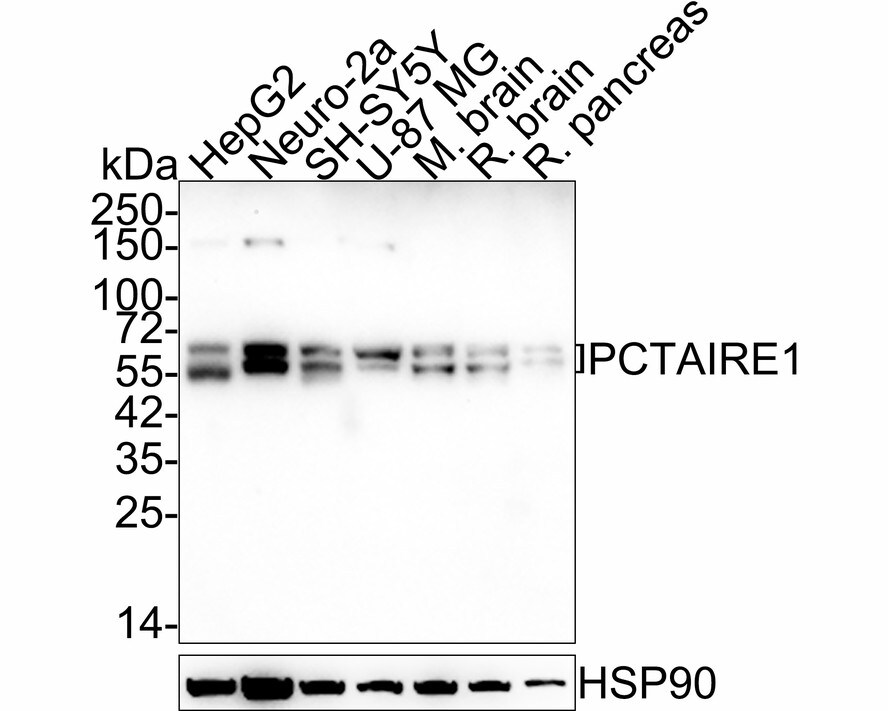 PCTAIRE1 Antibody (JE64-55) Western Blot: PCTAIRE1 Antibody (JE64-55) [NBP3-32727]