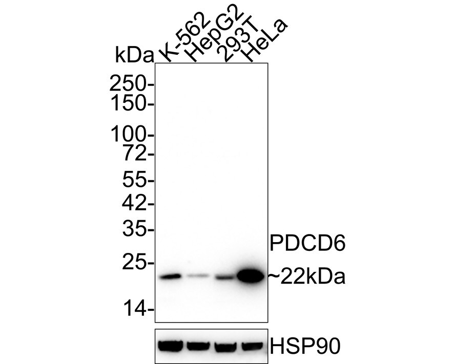 PDCD6 Antibody (A6A7-R) Western Blot: PDCD6 Antibody (A6A7-R) [NBP3-32728]