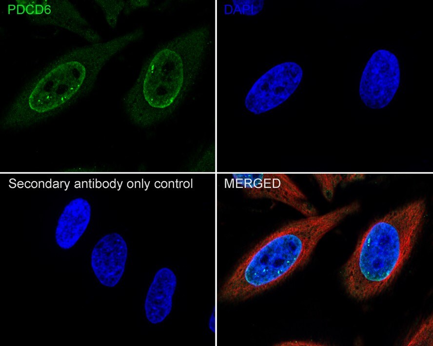 PDCD6 Antibody (A6A7-R)