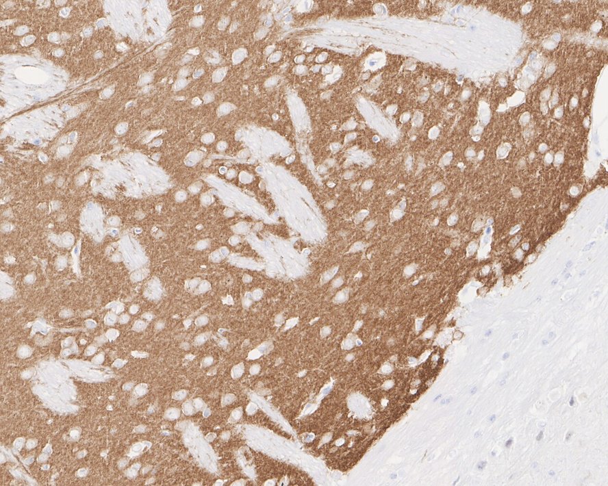 PDE10A Antibody (PSH03-61)