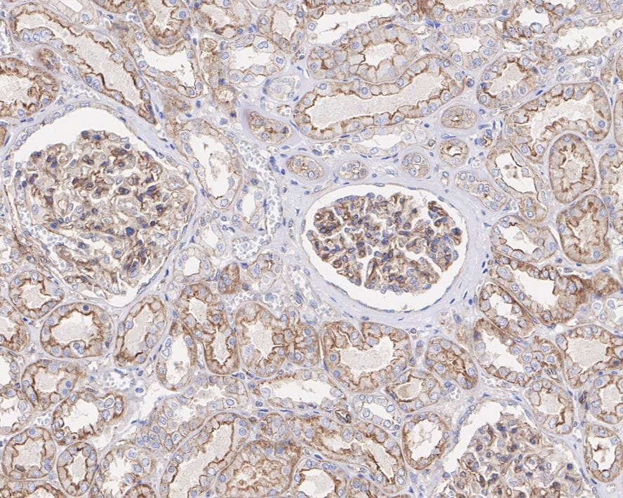 PDGF-B Antibody (JE75-16)