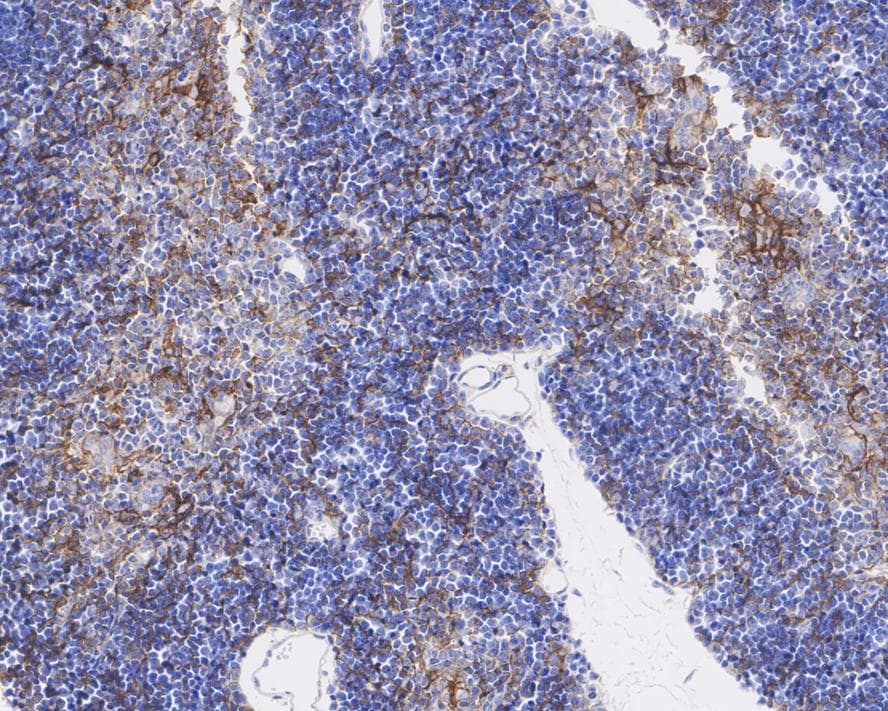 PD-L1 Antibody (PSH04-80)