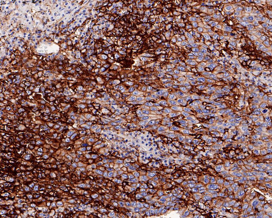 PD-L1 Antibody (PD01-02)