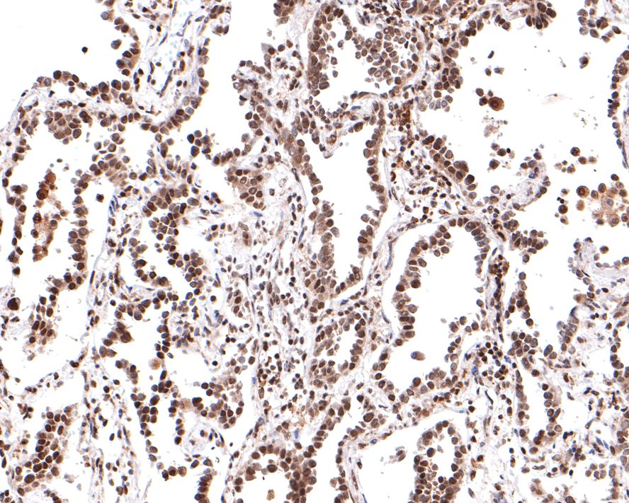 PER2 Antibody (JE33-79)