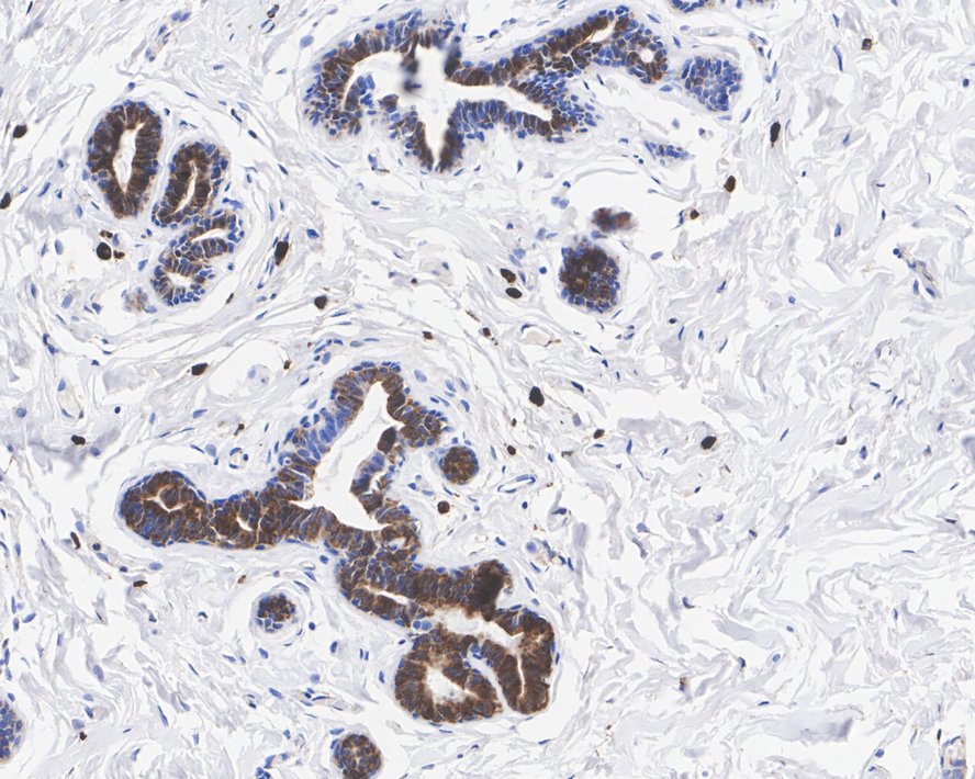 Peroxiredoxin 4 Antibody (PSH03-40)