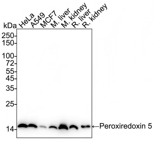 Peroxiredoxin 5 Antibody (PSH03-90) Western Blot: Peroxiredoxin 5 Antibody (PSH03-90) [NBP3-32740]