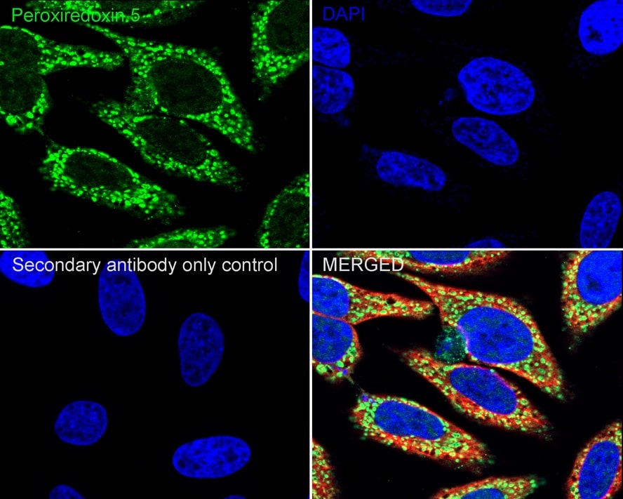 Peroxiredoxin 5 Antibody (PSH03-90)