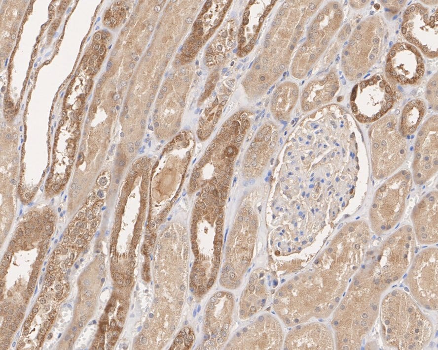 Peroxiredoxin 5 Antibody (PSH03-90)