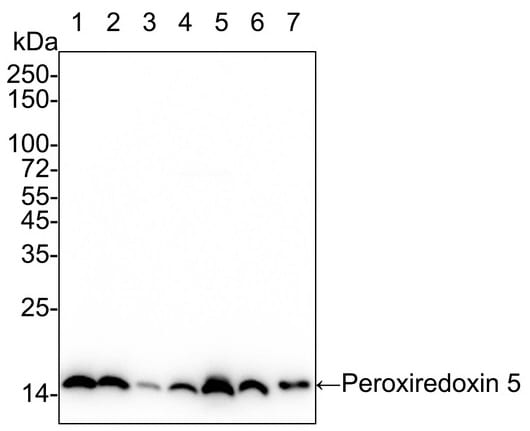 Peroxiredoxin 5 Antibody (PSH03-90)