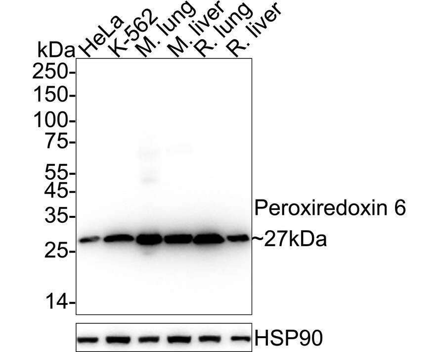 Peroxiredoxin 6 Antibody (7G1-R) Western Blot: Peroxiredoxin 6 Antibody (7G1-R) [NBP3-32741]