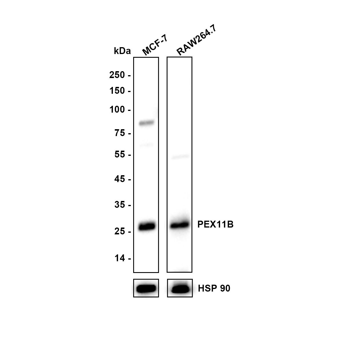 PEX11B Antibody (JE64-51) Western Blot: PEX11B Antibody (JE64-51) [NBP3-32742]