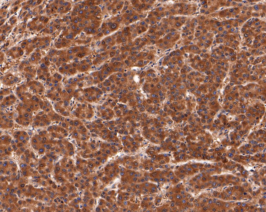 PEX11B Antibody (JE64-51)