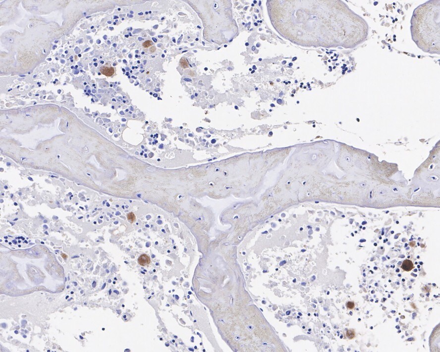 CXCL4/PF4 Antibody (JE31-48)