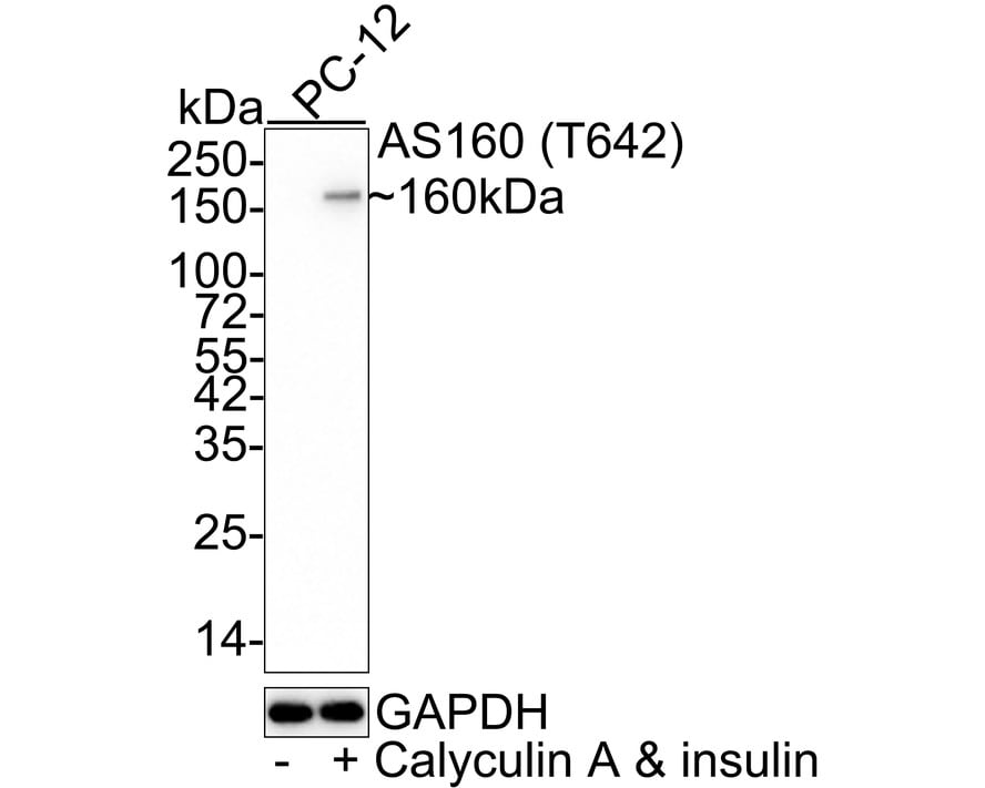 TBC1D4 [p Thr642] Antibody (JE60-97) Western Blot: TBC1D4 [p Thr642] Antibody (JE60-97) [NBP3-32749]