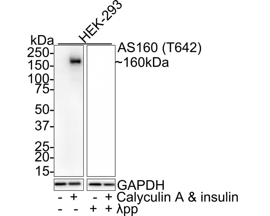 TBC1D4 [p Thr642] Antibody (JE60-97) Western Blot: TBC1D4 [p Thr642] Antibody (JE60-97) [NBP3-32749]