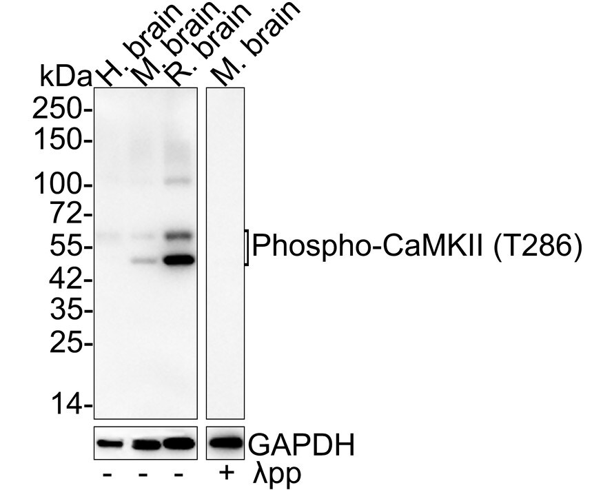 CaM Kinase II [p Thr286] Antibody (JE51-81) Western Blot: CaM Kinase II [p Thr286] Antibody (JE51-81) [NBP3-32752]