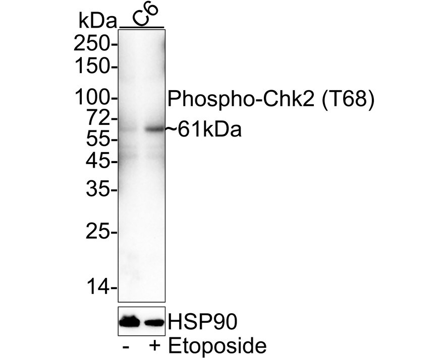 Chk2 [p Thr68] Antibody (JE43-12) Western Blot: Chk2 [p Thr68] Antibody (JE43-12) [NBP3-32756]