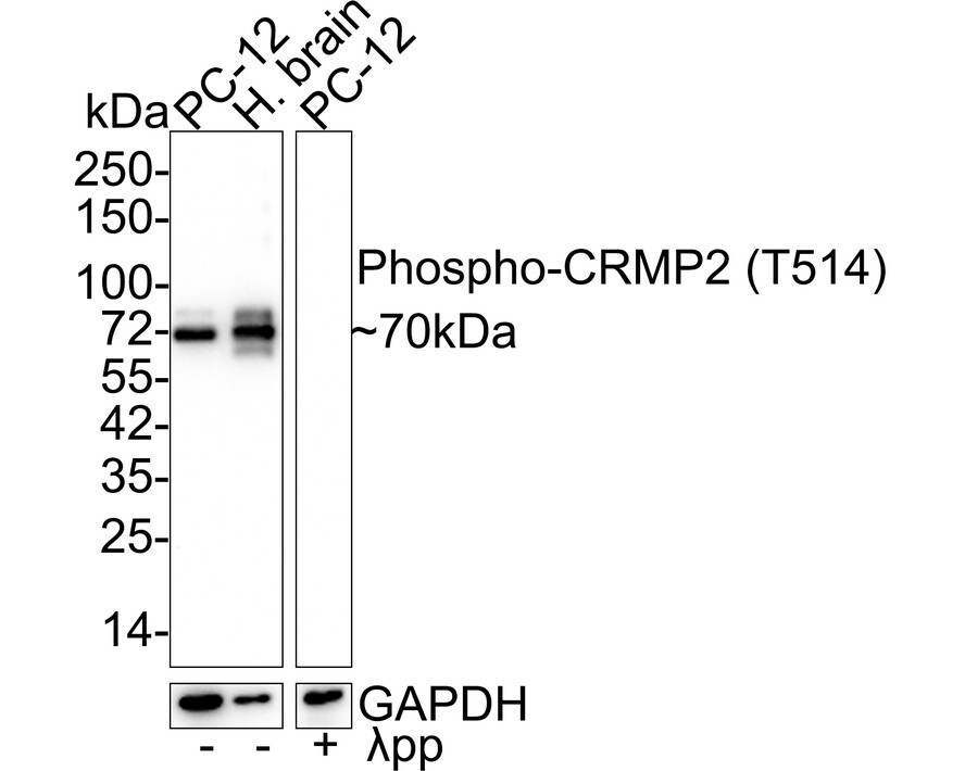 CRMP2 [p Thr514] Antibody (JE57-25) Western Blot: CRMP2 [p Thr514] Antibody (JE57-25) [NBP3-32758]
