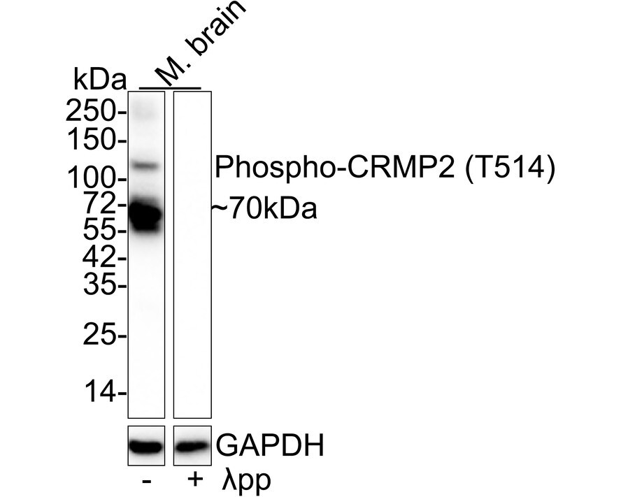 CRMP2 [p Thr514] Antibody (JE57-25) Western Blot: CRMP2 [p Thr514] Antibody (JE57-25) [NBP3-32758]