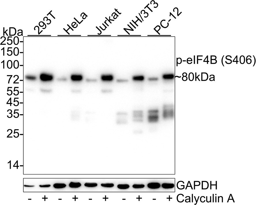 eIF4B [p Ser406] Antibody (JE63-80) Western Blot: eIF4B [p Ser406] Antibody (JE63-80) [NBP3-32763]