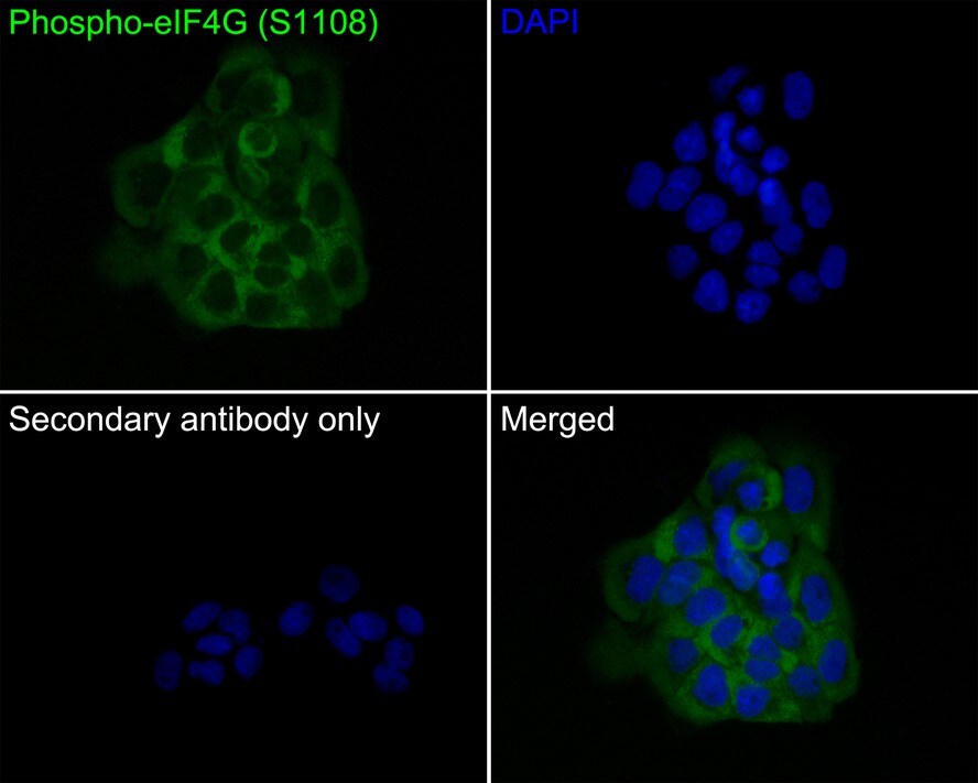 eIF4G1 [p Ser1108] Antibody (PS01-08)