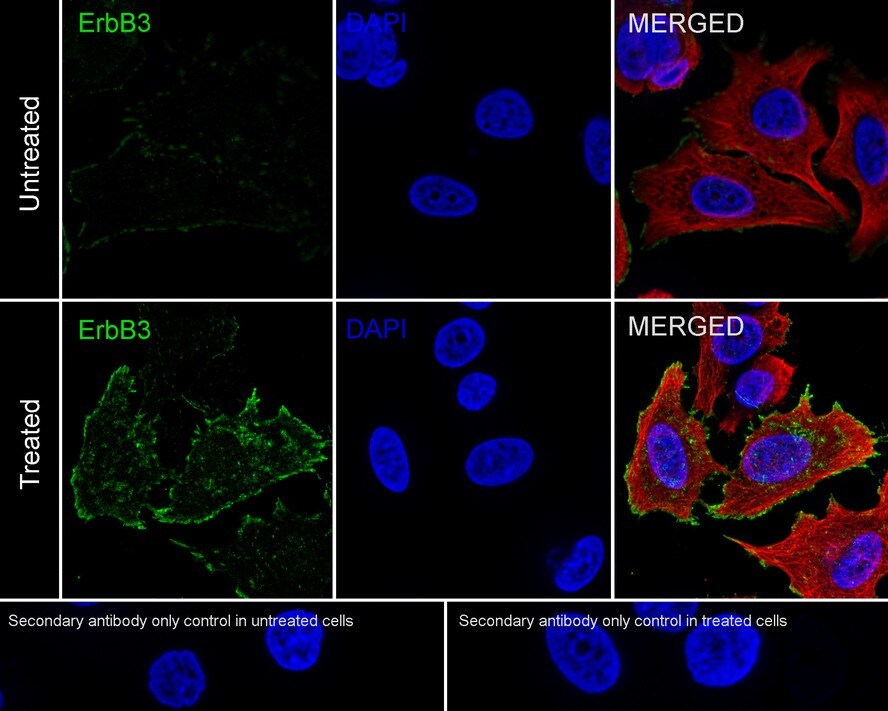 ErbB3/Her3 [p Tyr1289] Antibody (JE51-25)