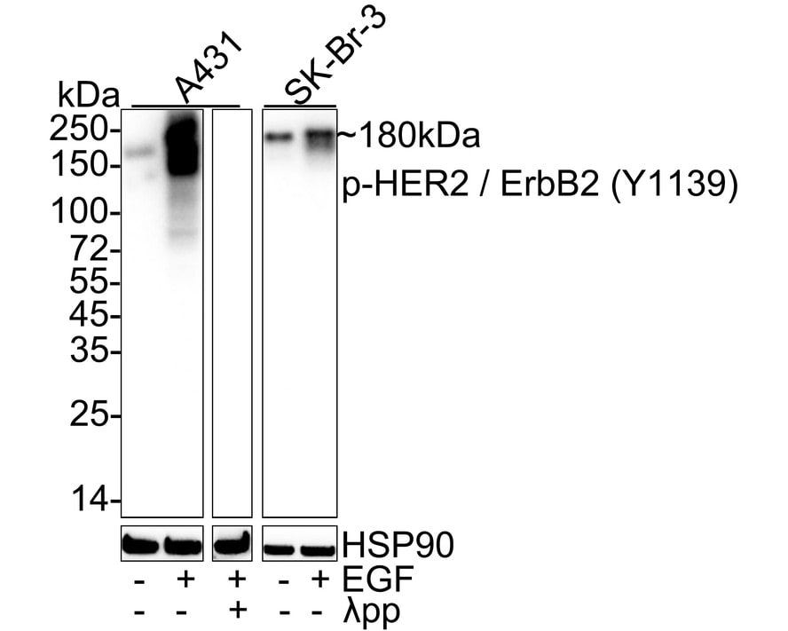 ErbB2/Her2 [p Tyr1139] Antibody (JE60-90)