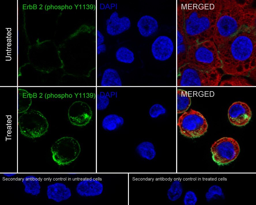 ErbB2/Her2 [p Tyr1139] Antibody (JE60-90)