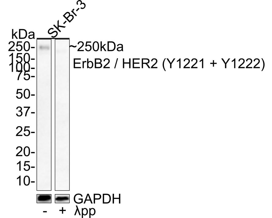 ErbB2/Her2 [p Tyr1221, p Tyr1222] Antibody (JE44-12)