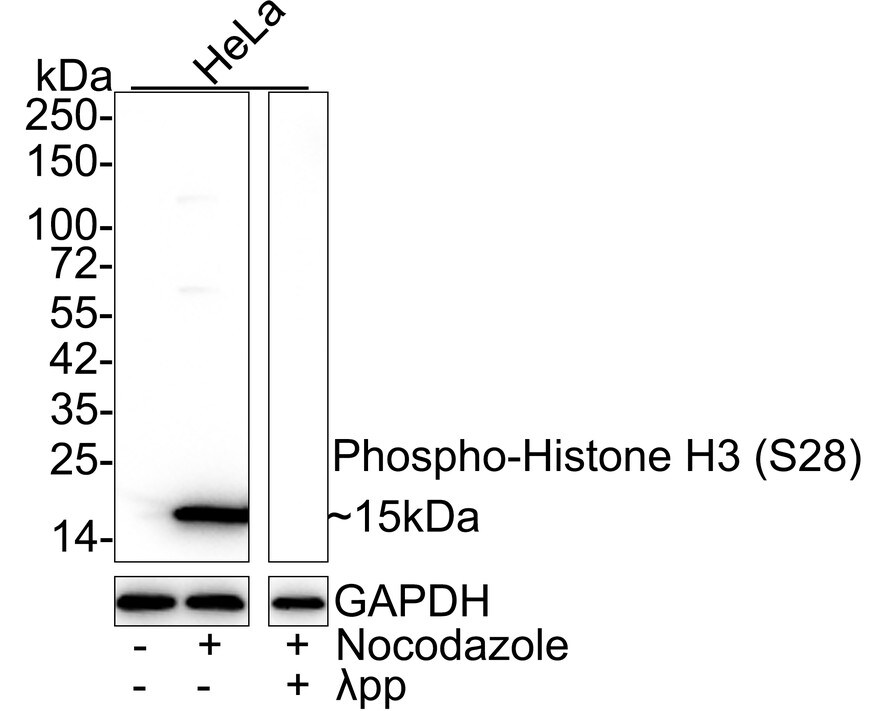 Histone H3 [p Ser28] Antibody (JE56-06)
