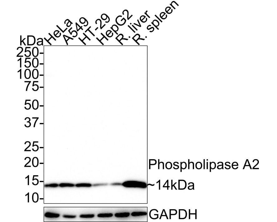 PLA2G2A Antibody (JE41-02) Western Blot: PLA2G2A Antibody (JE41-02) [NBP3-32775]