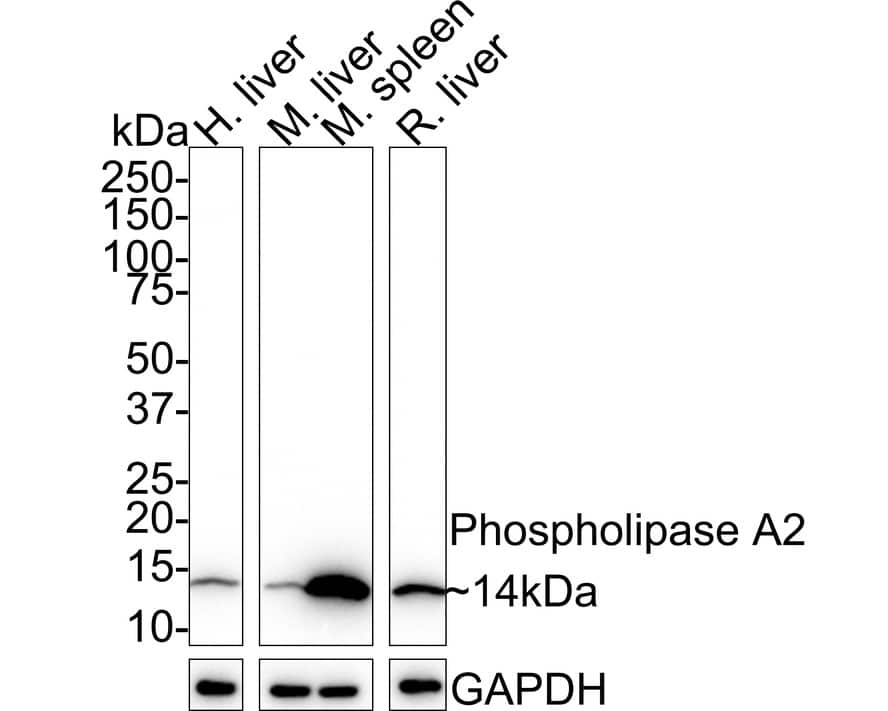 PLA2G2A Antibody (JE41-02) Western Blot: PLA2G2A Antibody (JE41-02) [NBP3-32775]