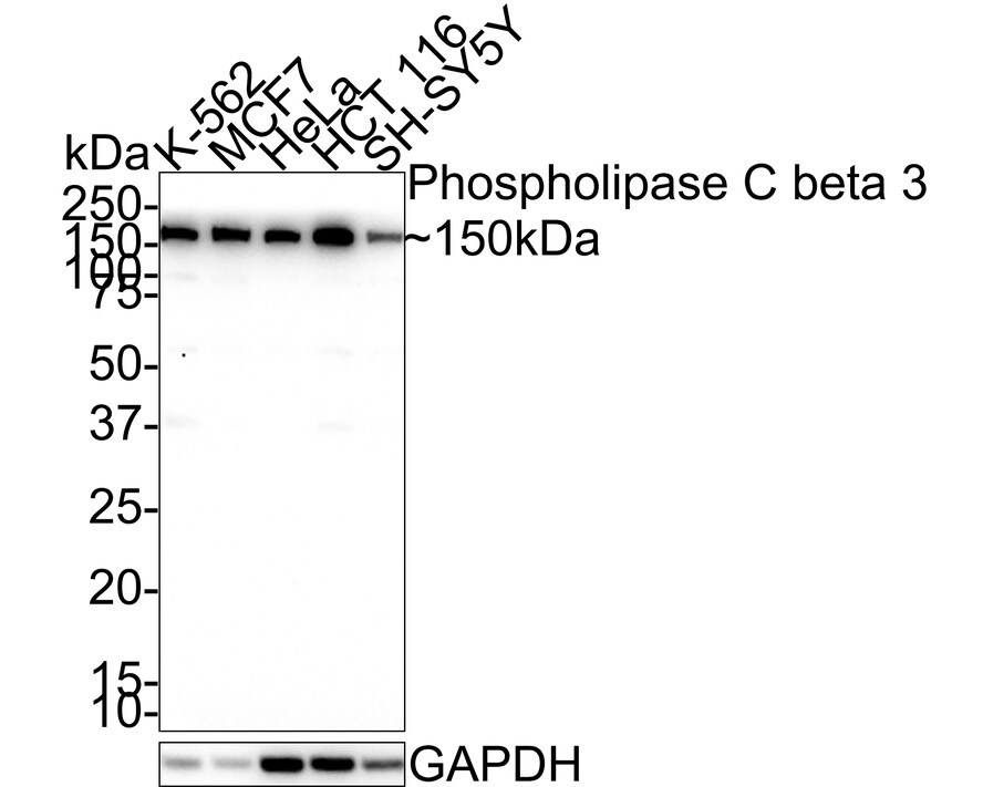 PLC-beta 3 Antibody (JE39-14) Western Blot: PLC-beta 3 Antibody (JE39-14) [NBP3-32776]