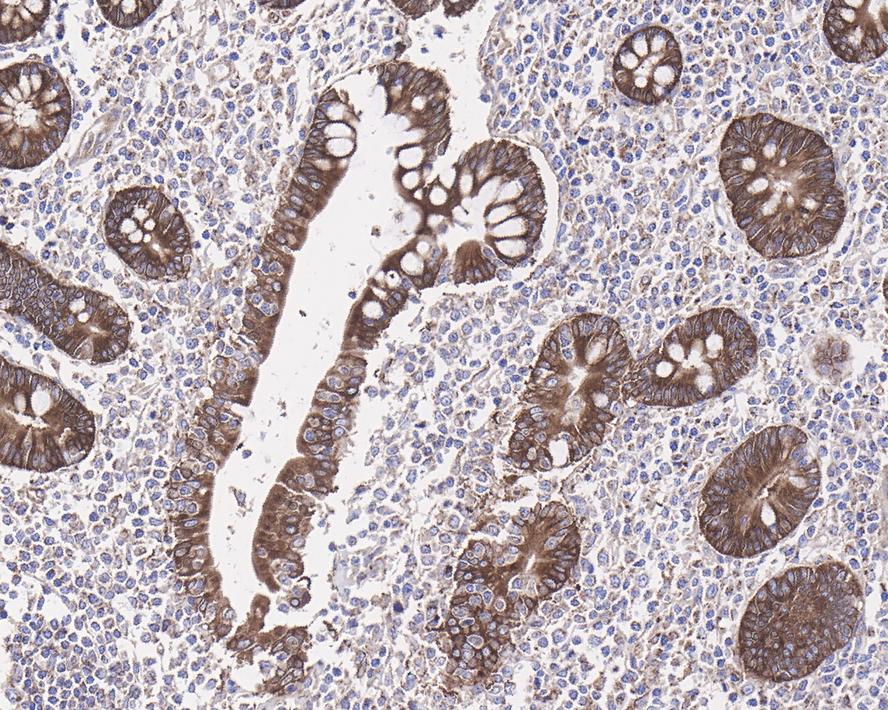 PLC-beta 3 Antibody (JE39-14)