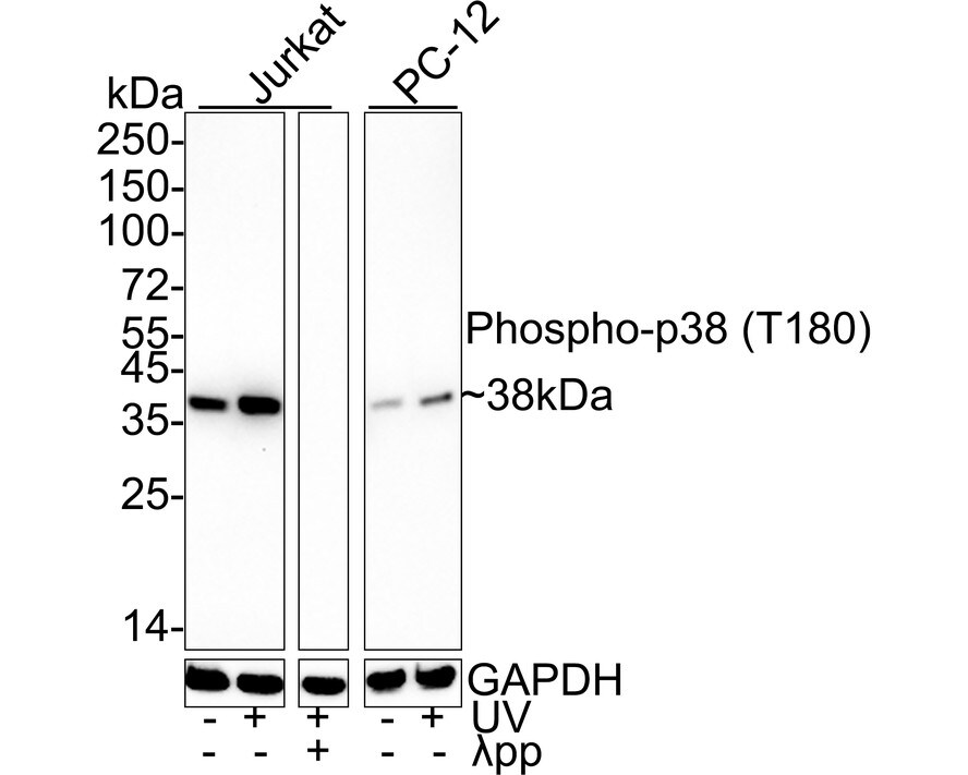 p38 alpha [p Thr180] Antibody (JE77-37) Western Blot: p38 alpha [p Thr180] Antibody (JE77-37) [NBP3-32781]