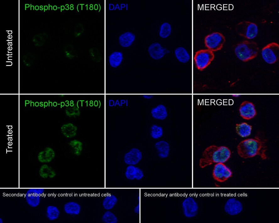 p38 alpha [p Thr180] Antibody (JE77-37)
