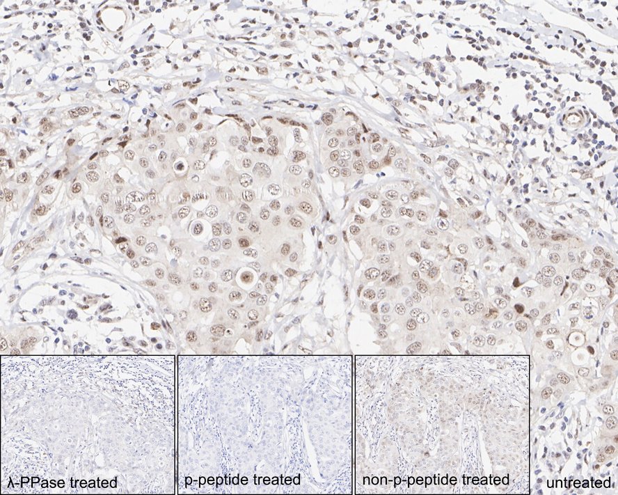 p38 alpha [p Thr180] Antibody (JE77-37)
