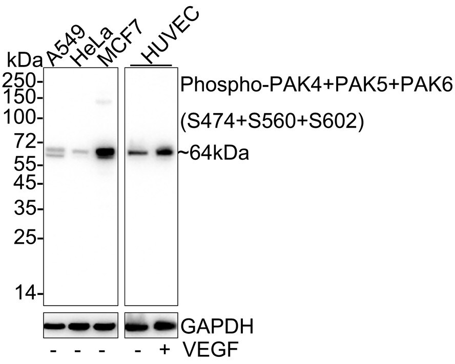 PAK4+5+6 [p Ser602, p Ser474, p Ser560] Antibody (JE57-42) Western Blot: PAK4+5+6 [p Ser602, p Ser474, p Ser560] Antibody (JE57-42) [NBP3-32784]
