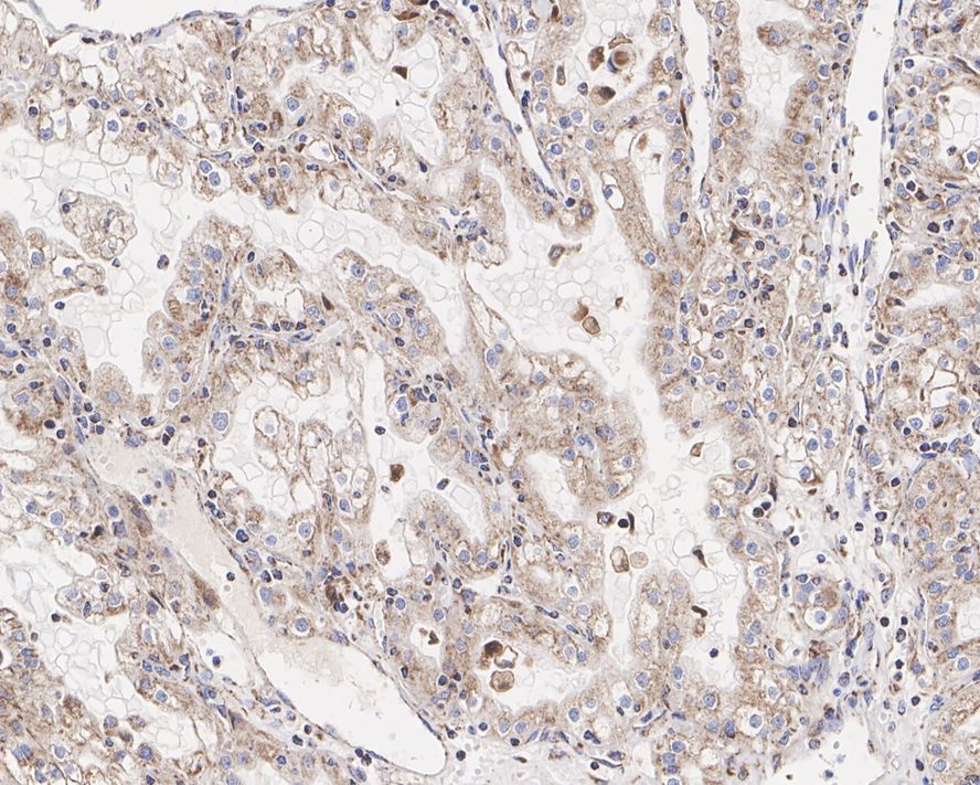 Pyruvate Dehydrogenase E1-alpha subunit [p Ser293] Antibody (JE58-27)